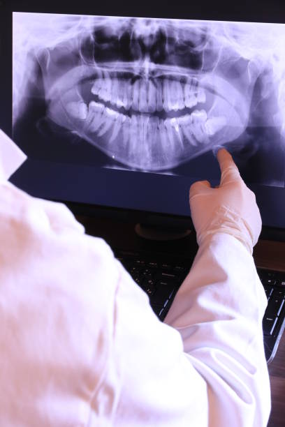 Best Teeth Whitening  in Ransomville, NY