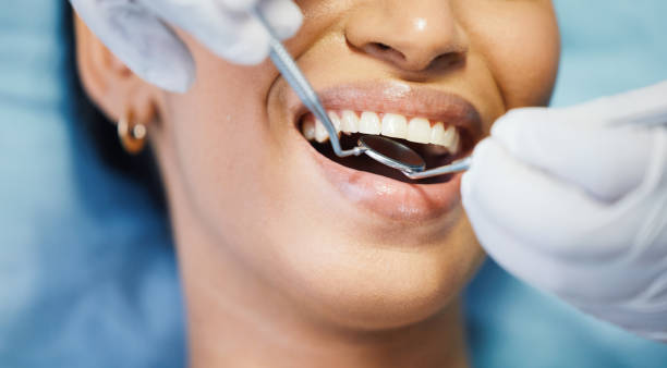 Best Chipped Tooth Repair Near Me  in Ransomville, NY